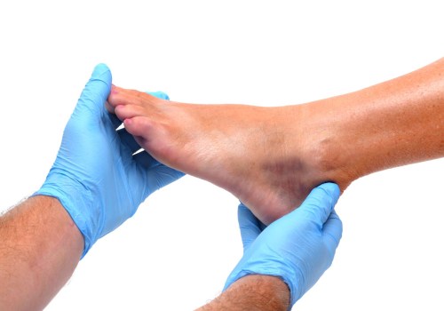 Why You Should Consider Seeing a Podiatrist