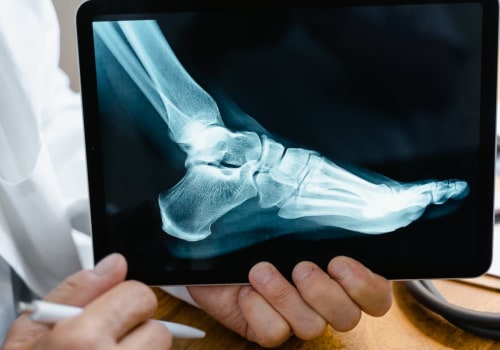 Why Podiatry is Not Considered Medical School